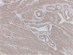 3003B | Control Slides:Immunopathology; Actin, Smooth Muscle